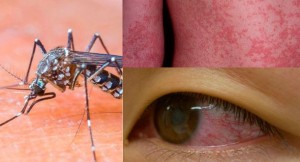 zika