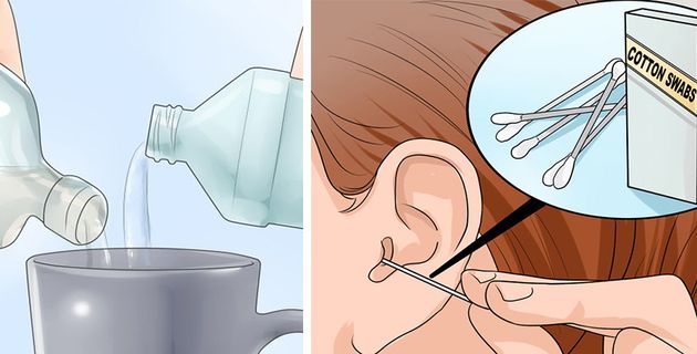 limpieza de oido
