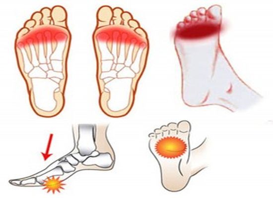 ¿Te duele algún Dedo de los Pies? | Tu Salud Es Vida.