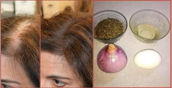 cebolla y cabello