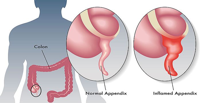 apendice